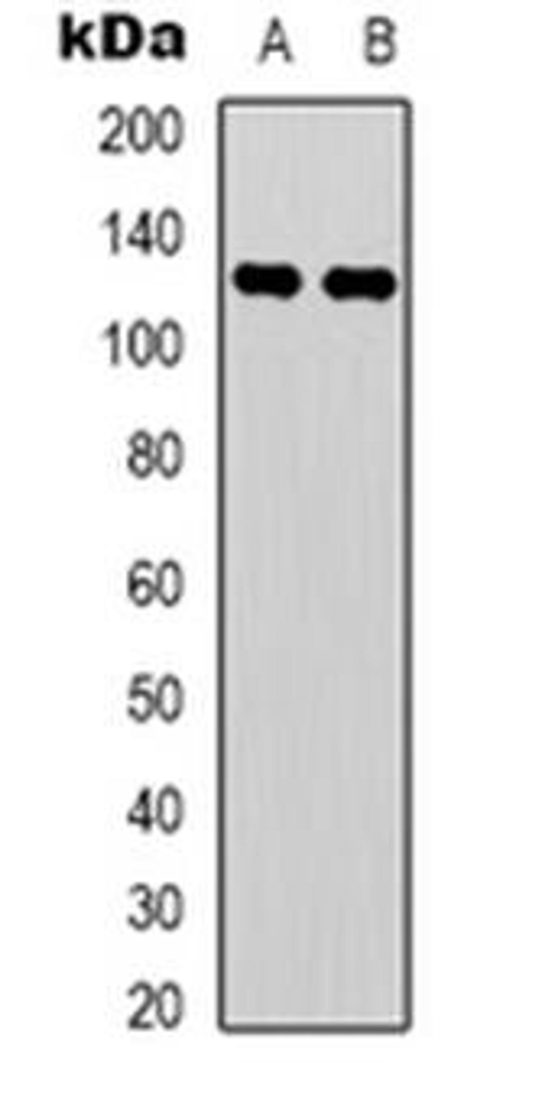 Western blot analysis of C/EBP zeta expression in H460 (Lane 1), COLO205 (Lane 2) whole cell lysates using CEBPZ antibody