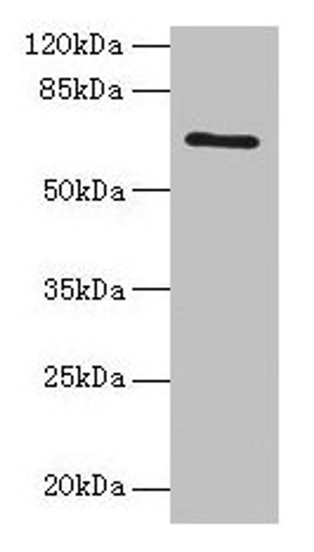 Western blot. All lanes: HEATR9 antibody at 1.2µg/ml + Jurkat whole cell lysate. Secondary. Goat polyclonal to rabbit IgG at 1/10000 dilution. Predicted band size: 66, 27, 61, 45, 40 kDa. Observed band size: 66 kDa