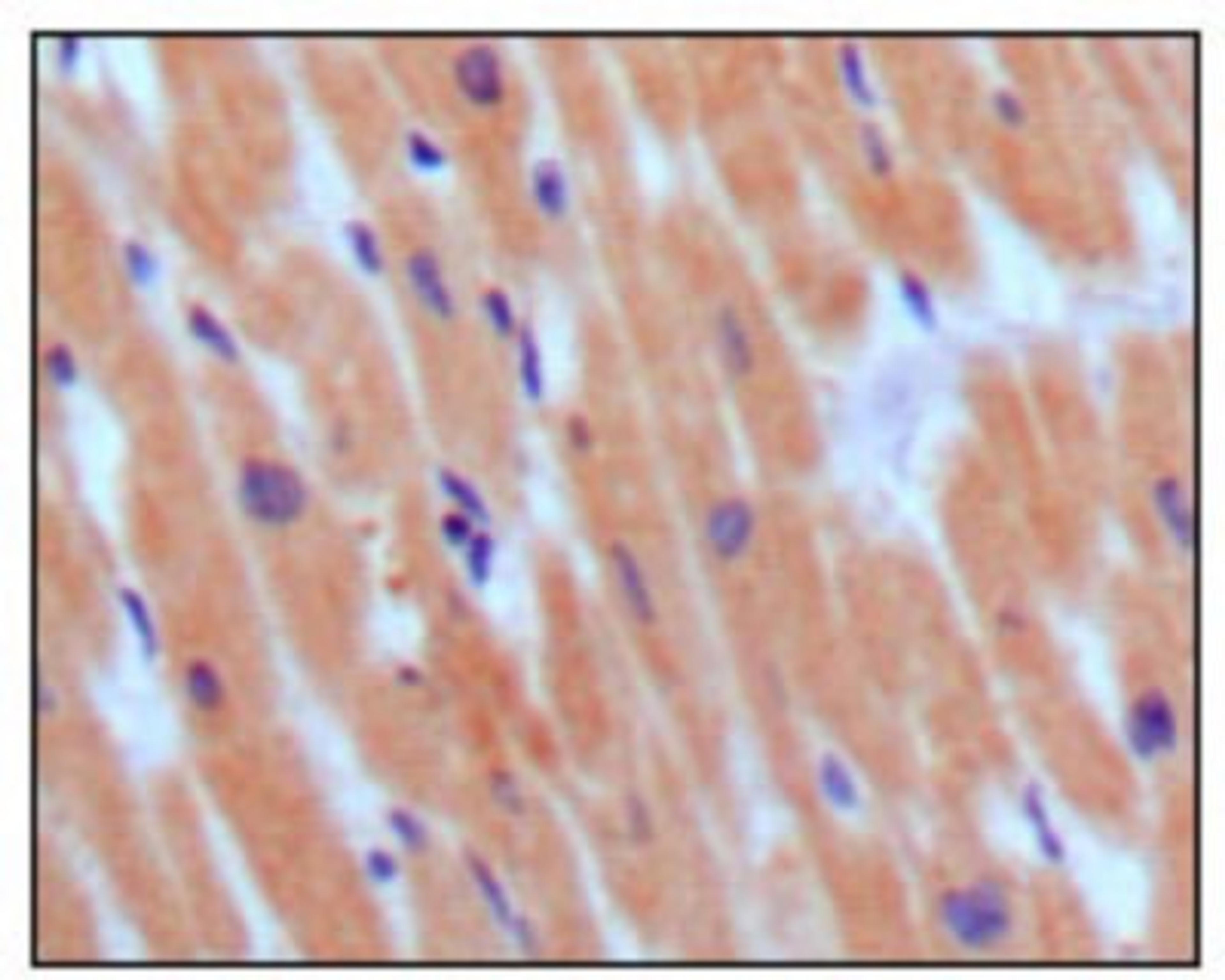 Immunohistochemistry-Paraffin: proBNP Antibody (3A6F7C7) [NBP1-47509] - Analysis of human normal myocardium, showing cytoplasmic localization using BNP3 mouse mAb with DAB staining.