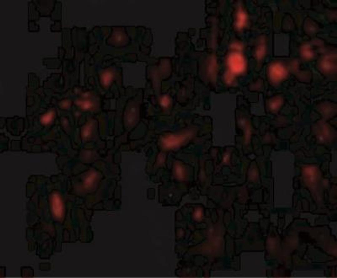 Immunocytochemistry/Immunofluorescence: Calpain 6 Antibody [NBP1-76937] -  Calpain 6  in Human Lung cells with CAPN6 antibody at 20 ug/mL.