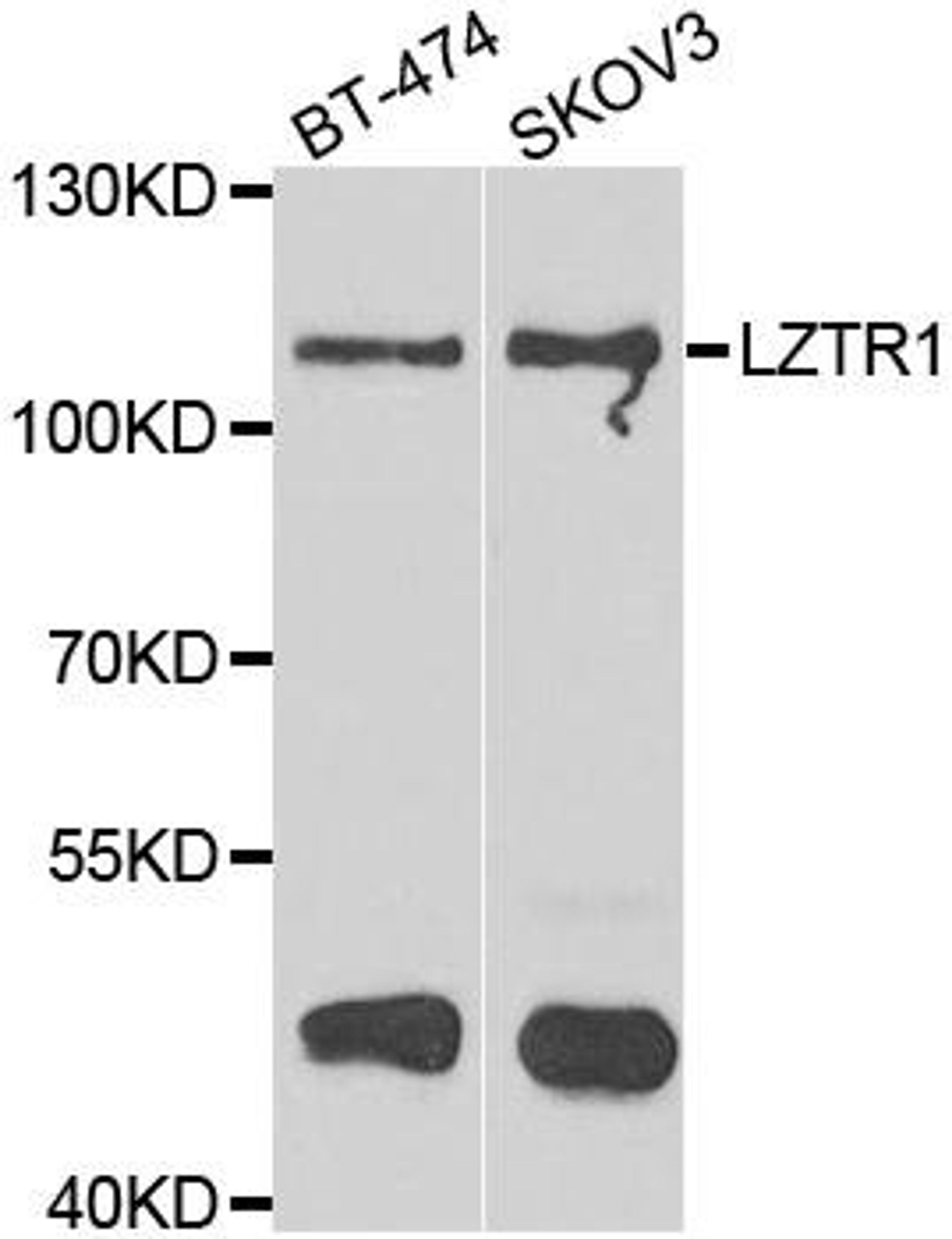 Western blot analysis of extracts of various cell lines using LZTR1 antibody