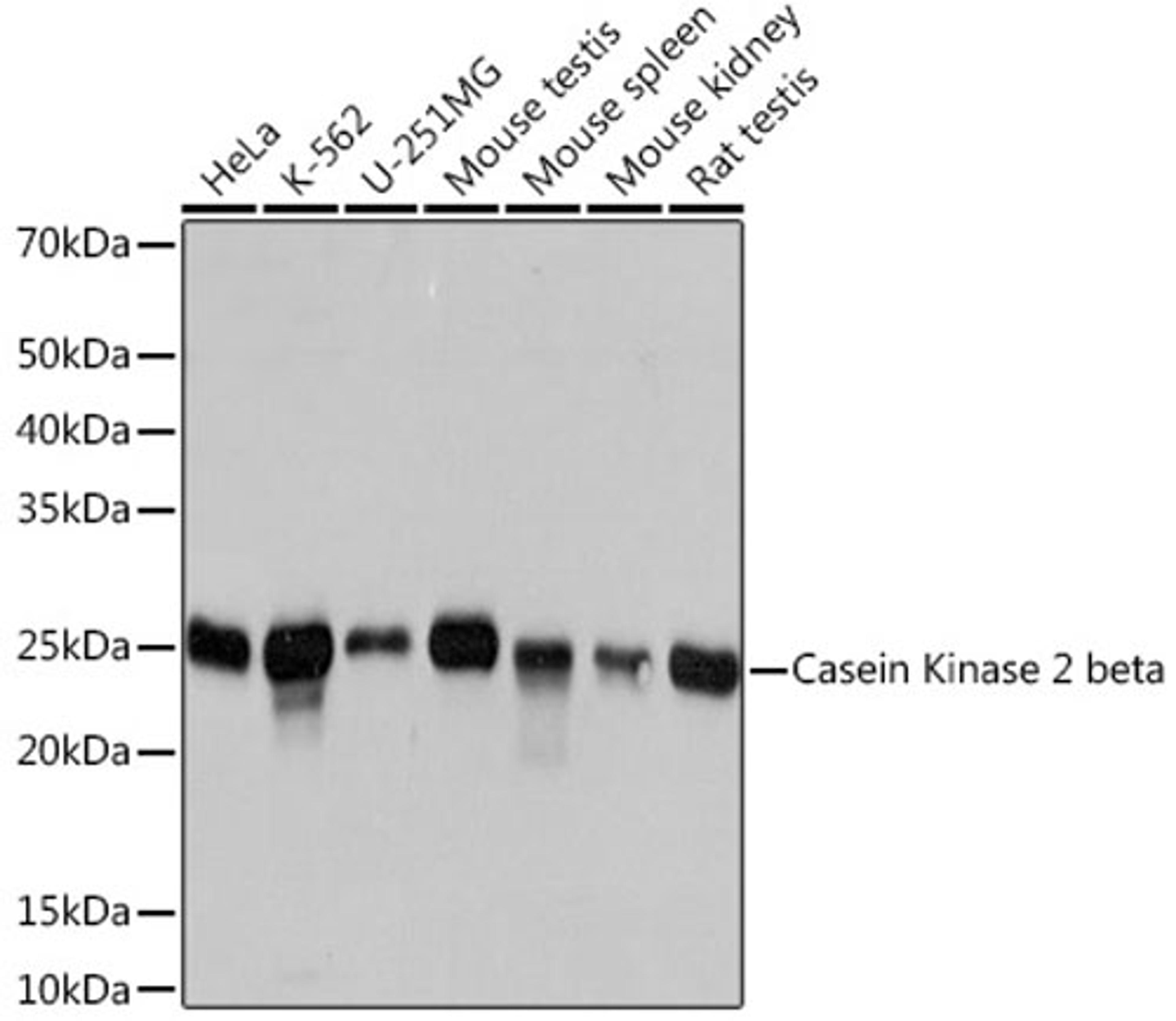 Western blot - Casein Kinase 2 beta Rabbit mAb (A4519)