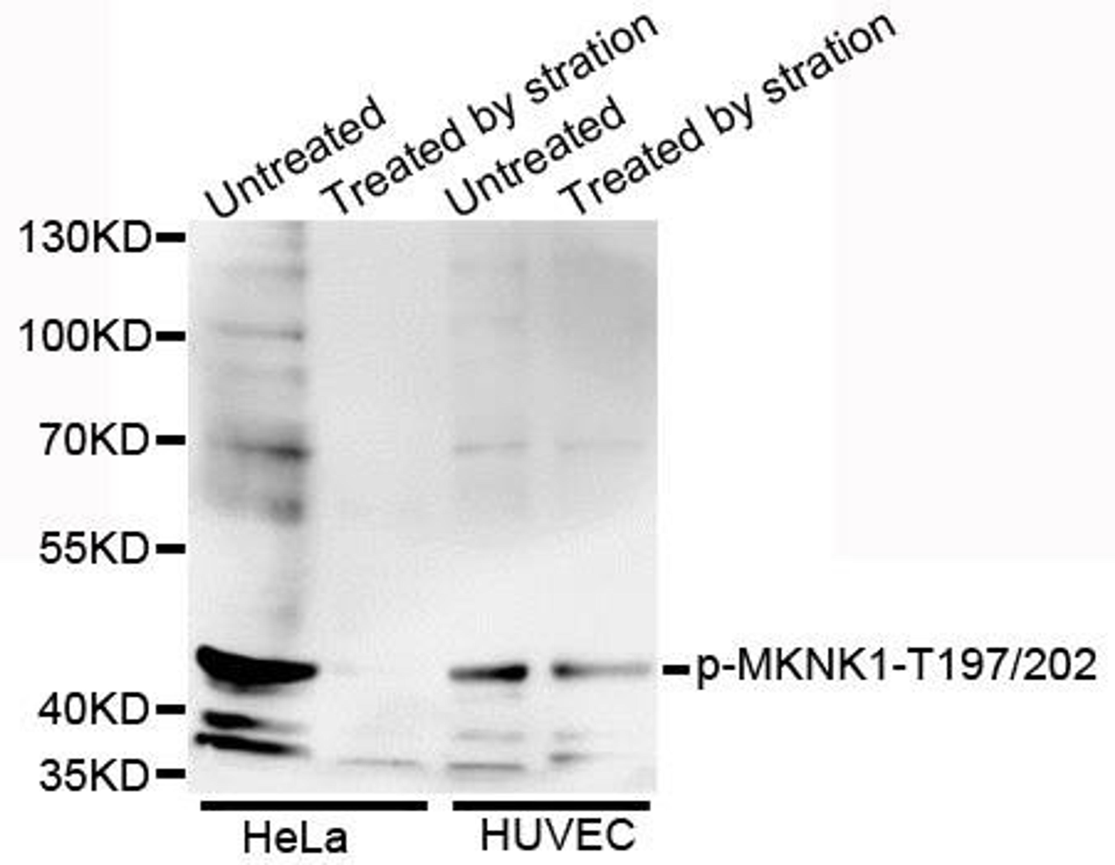 Western blot analysis of extracts of various cell lines using MKNK1 (Phospho-T197/202) antibody