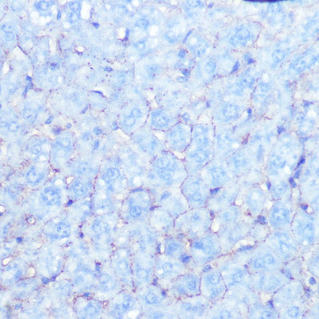 Immunohistochemistry - Na+/K+-ATPase Rabbit mAb (A11683)