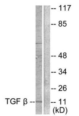 Western blot analysis of COS7 cells using TGF ?3 antibody.