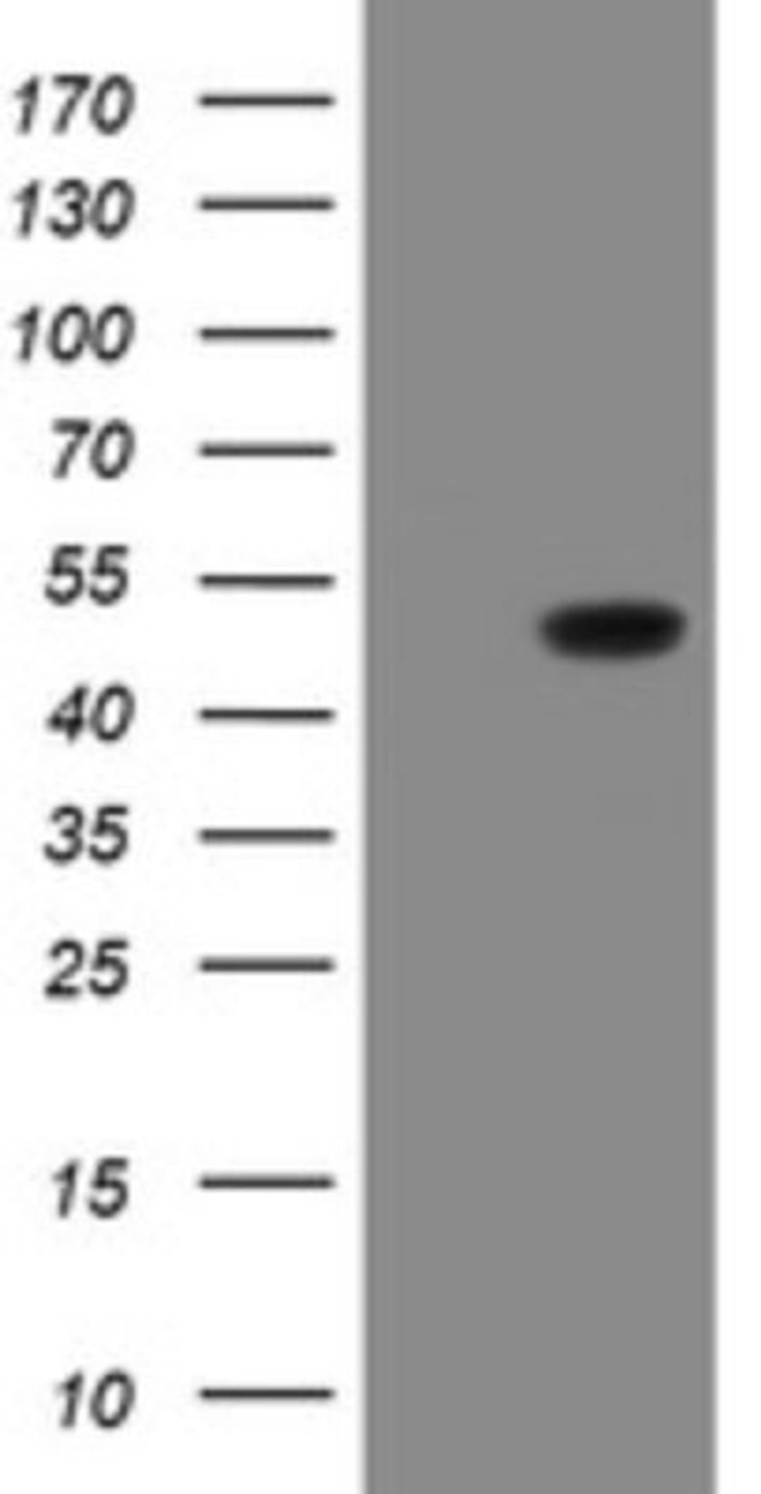 Western Blot: SCYL1BP1 Antibody (4F11) [NBP2-45912] - Analysis of HEK293T cells were transfected with the pCMV6-ENTRY control (Left lane) or pCMV6-ENTRY SCYL1BP1.