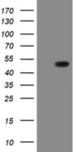 Western Blot: SCYL1BP1 Antibody (4F11) [NBP2-45912] - Analysis of HEK293T cells were transfected with the pCMV6-ENTRY control (Left lane) or pCMV6-ENTRY SCYL1BP1.