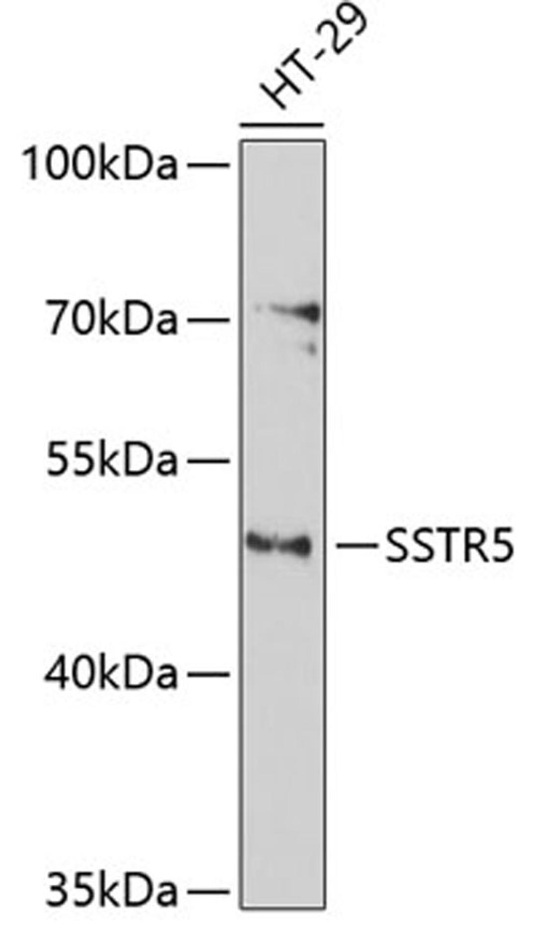 Western blot - SSTR5 antibody (A3136)