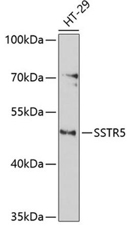 Western blot - SSTR5 antibody (A3136)