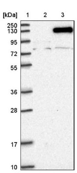 Western Blot: NCKAP1 Antibody [NBP1-83269] - Lane 1: Marker [kDa] 250, 130, 95, 72, 55, 36, 28, 17, 10<br/>Lane 2: Negative control (vector only transfected HEK293T lysate)<br/>Lane 3: Over-expression lysate (Co-expressed with a C-terminal myc-DDK tag (~3.1 kDa) in mammalian HEK293T cells, LY415547)