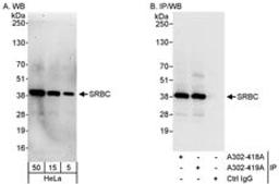 Detection of human SRBC by western blot and immunoprecipitation.