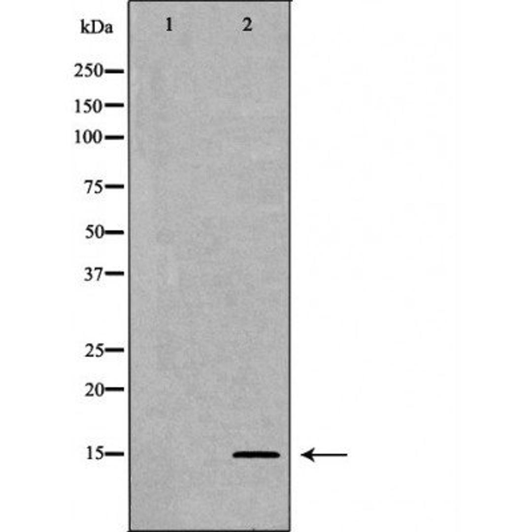 Western blot analysis of HeLa cell line and H3 protein expressed in E.coli using Histone H3K27me2 antibody