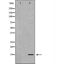 Western blot analysis of HeLa cell line and H3 protein expressed in E.coli using Histone H3K27me2 antibody