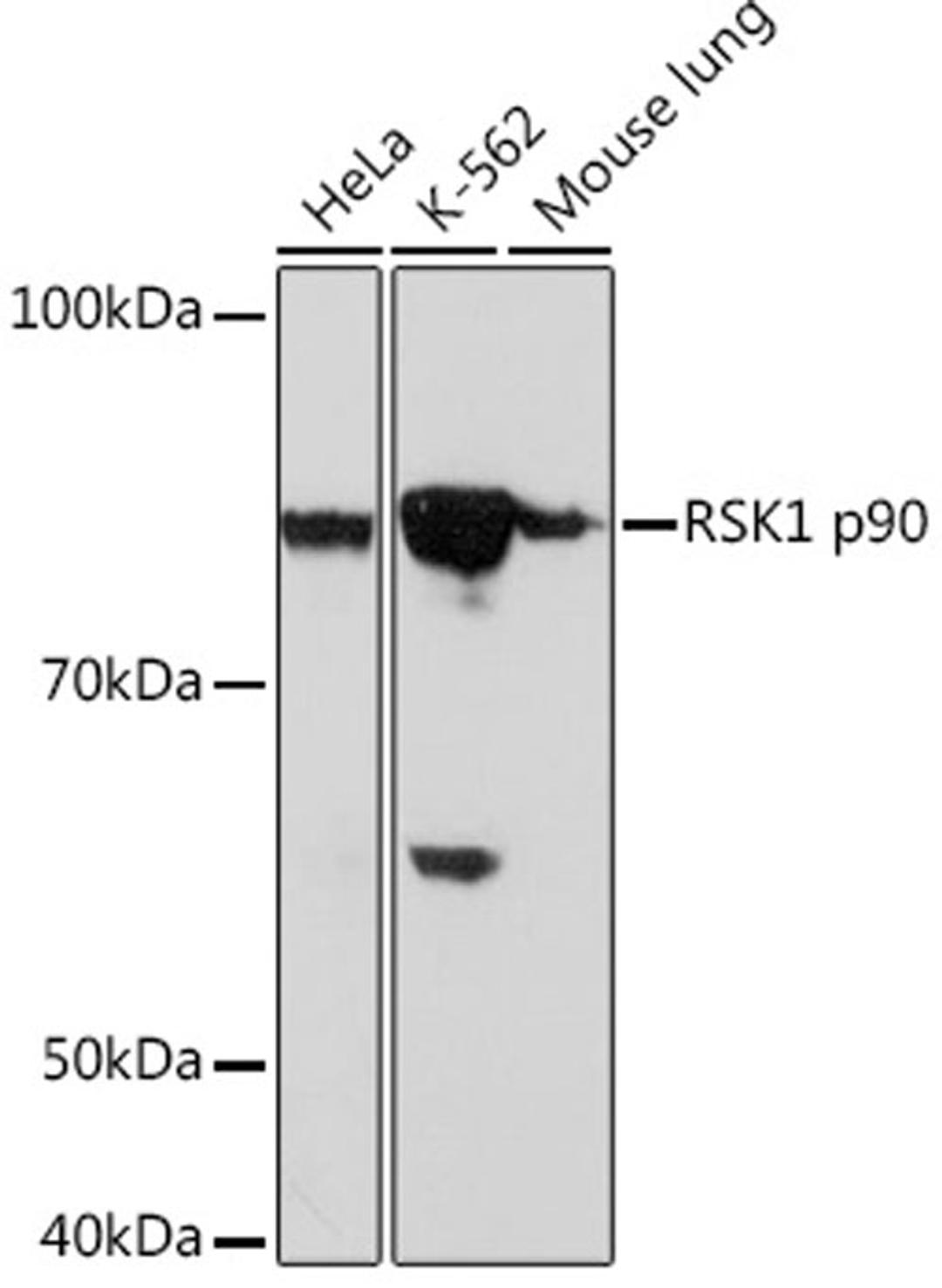 Western blot - RSK1 p90 Rabbit mAb (A4695)