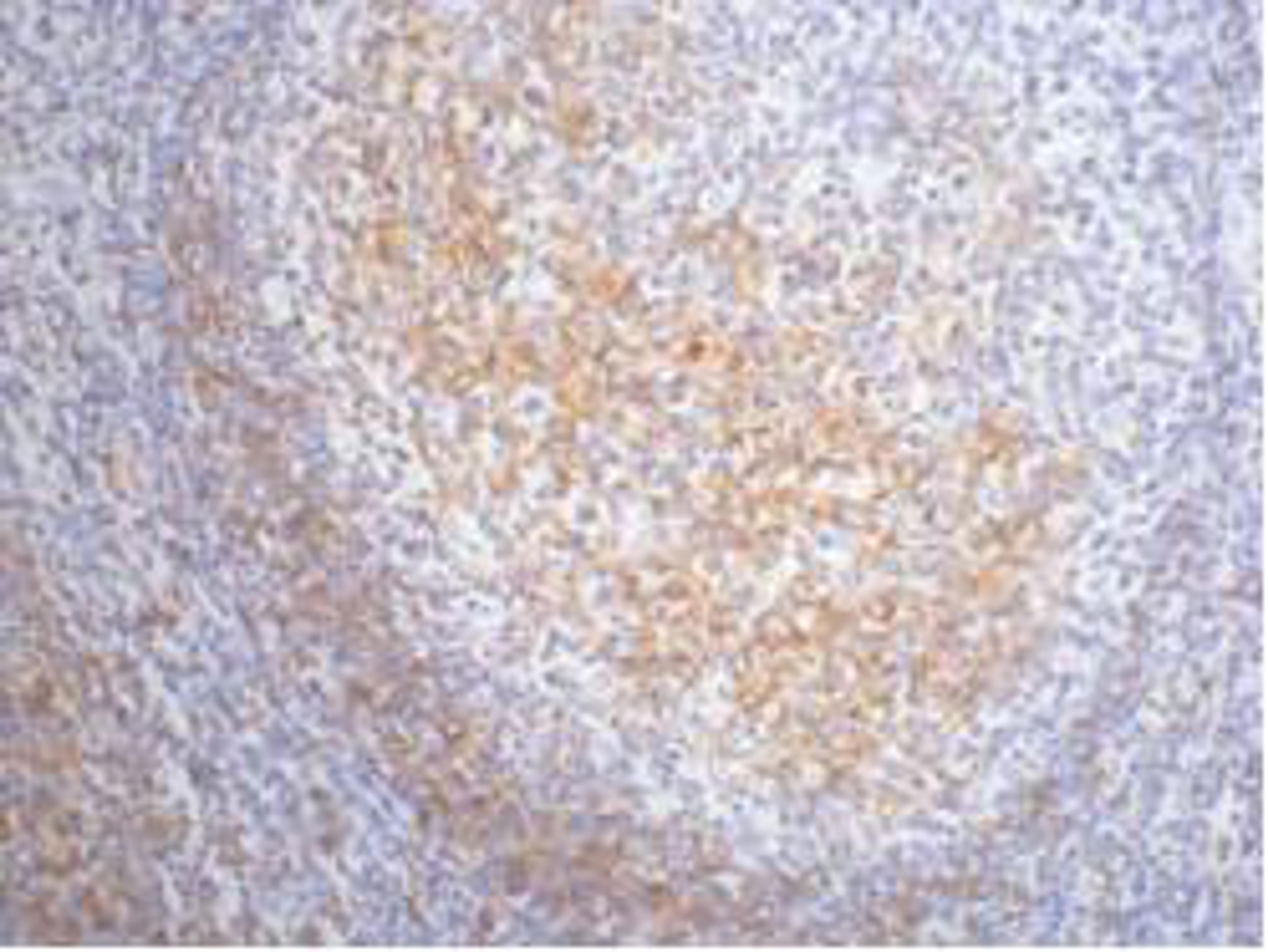IHC staining of Human tonsil tissue paraffin-embedded, diluted at 1:200.