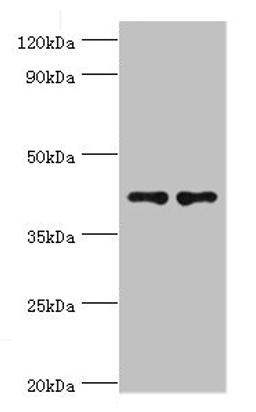 Western blot. All lanes: CD33 antibody at 8µg/ml. Lane 1: K562 whole cell lysate. Lane 2: HepG2 whole cell lysate. Secondary. Goat polyclonal to rabbit IgG at 1/10000 dilution. Predicted band size: 40, 34, 26 kDa. Observed band size: 40 kDa