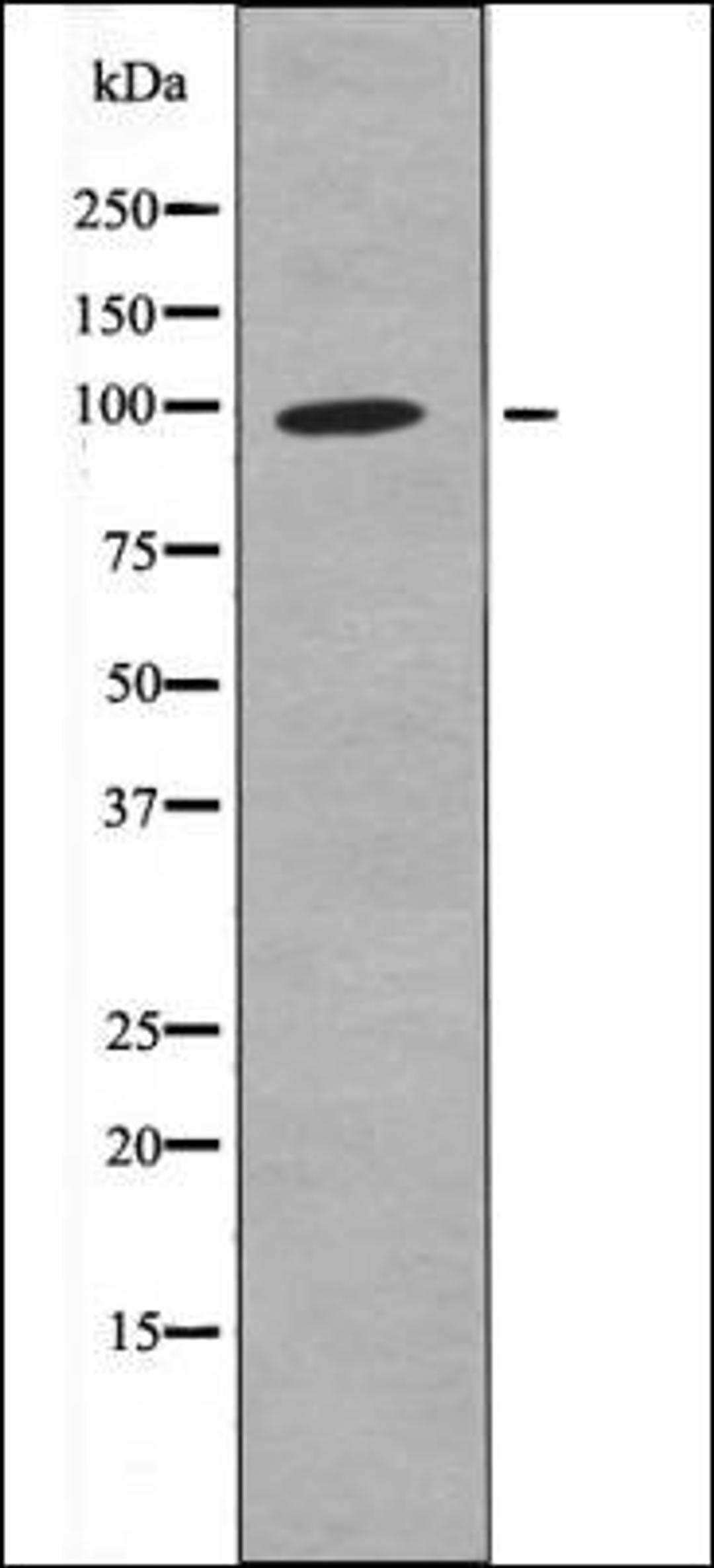 Western blot analysis of EGF treated K562 whole cell lysates using FKHRL1 -Phospho-Ser321- antibody