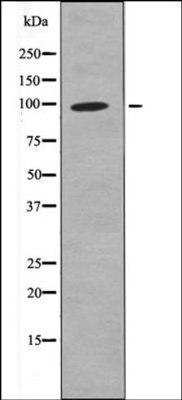 Western blot analysis of EGF treated K562 whole cell lysates using FKHRL1 -Phospho-Ser321- antibody