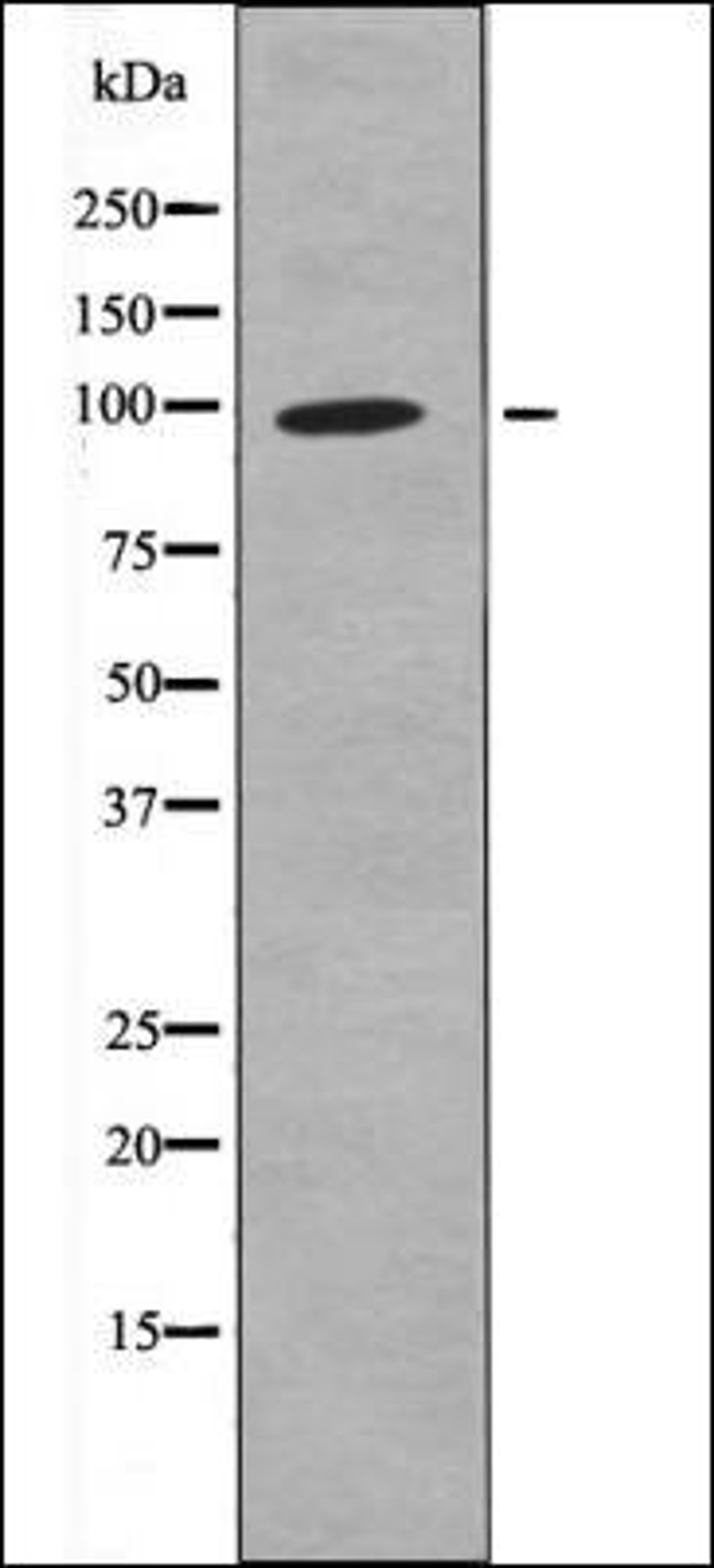 Western blot analysis of EGF treated K562 whole cell lysates using FKHRL1 -Phospho-Ser321- antibody