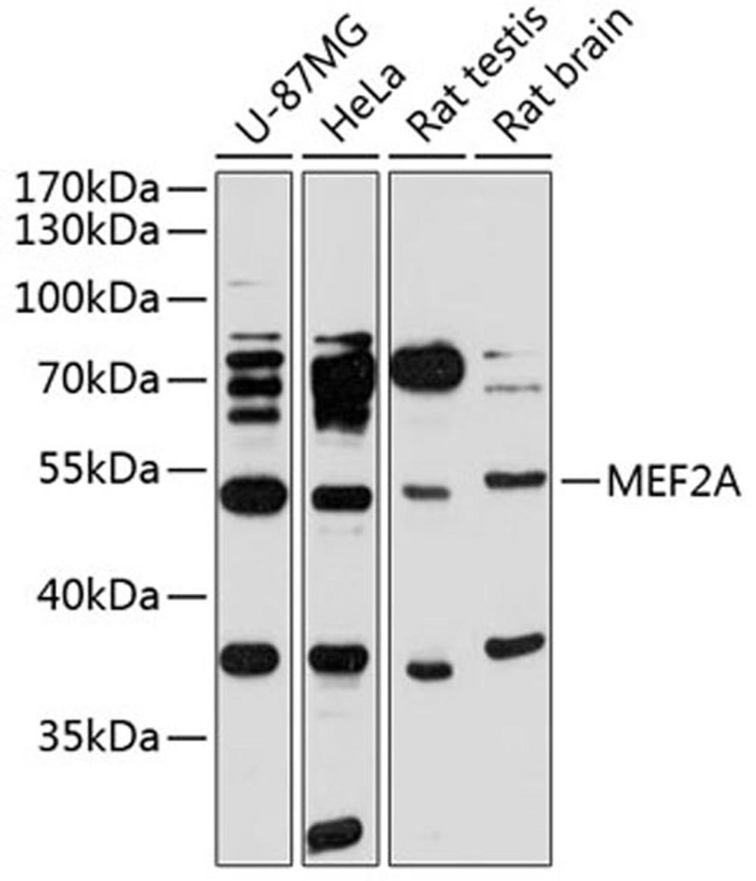 Western blot - MEF2A antibody (A12059)