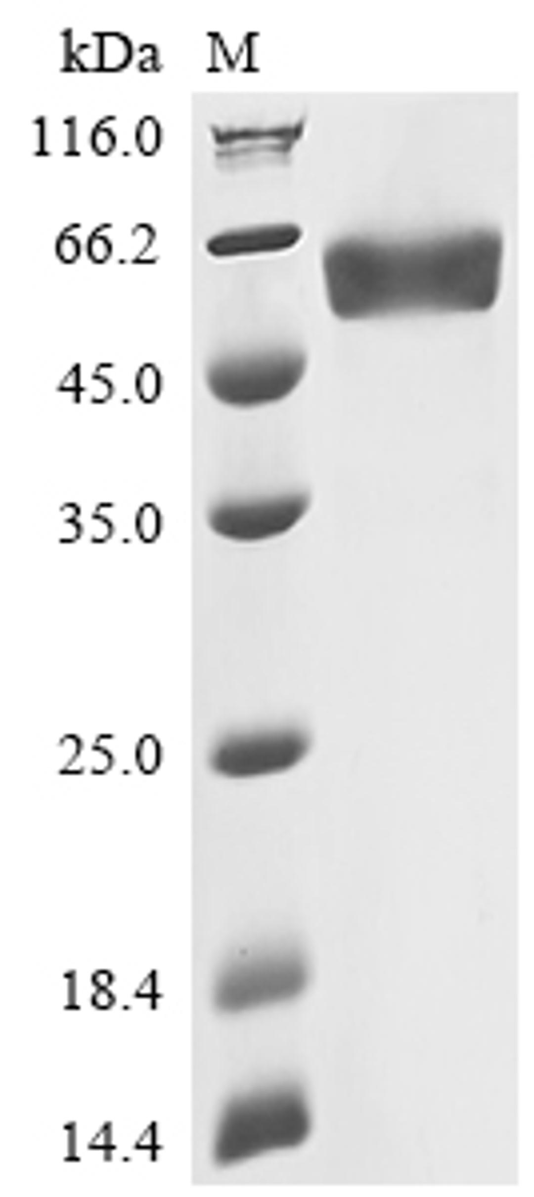 (Tris-Glycine gel) Discontinuous SDS-PAGE (reduced) with 5% enrichment gel and 15% separation gel.