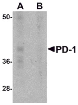 Western blot analysis of PD-1 in A-20 cell lysate with PD-1 antibody at 1 μg/mL in the (A) absence and (B) presence of blocking recombinant protein.