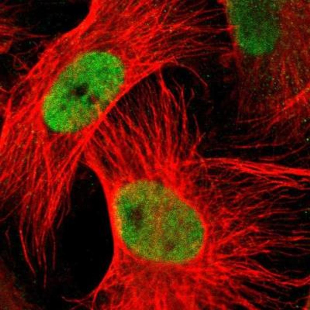 Immunocytochemistry/Immunofluorescence: Metallothionein-3 Antibody [NBP1-89772] - Staining of human cell line U-251 MG shows positivity in nucleus but not nucleoli.