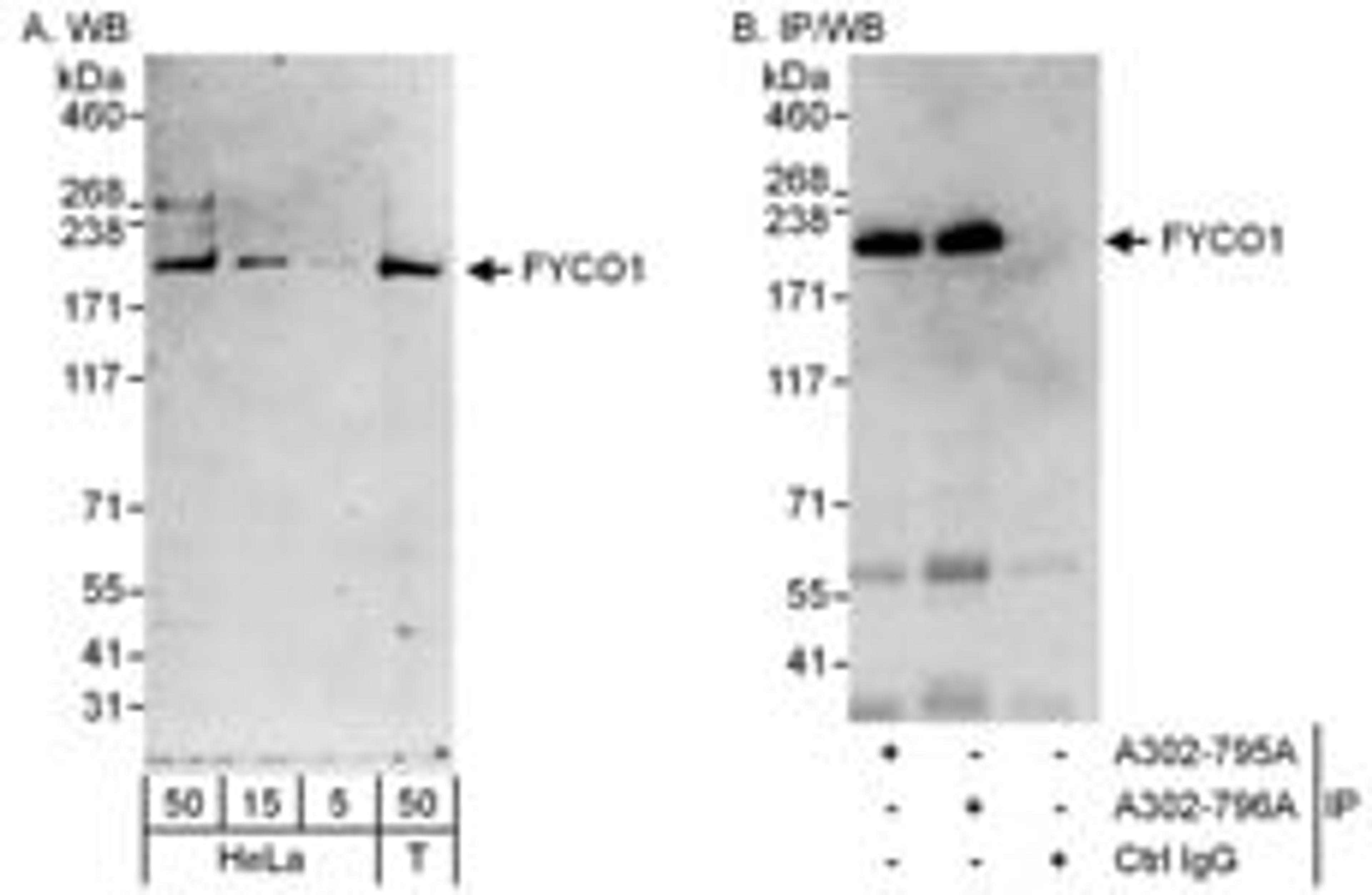 Detection of human FYCO1 by western blot and immunoprecipitation.