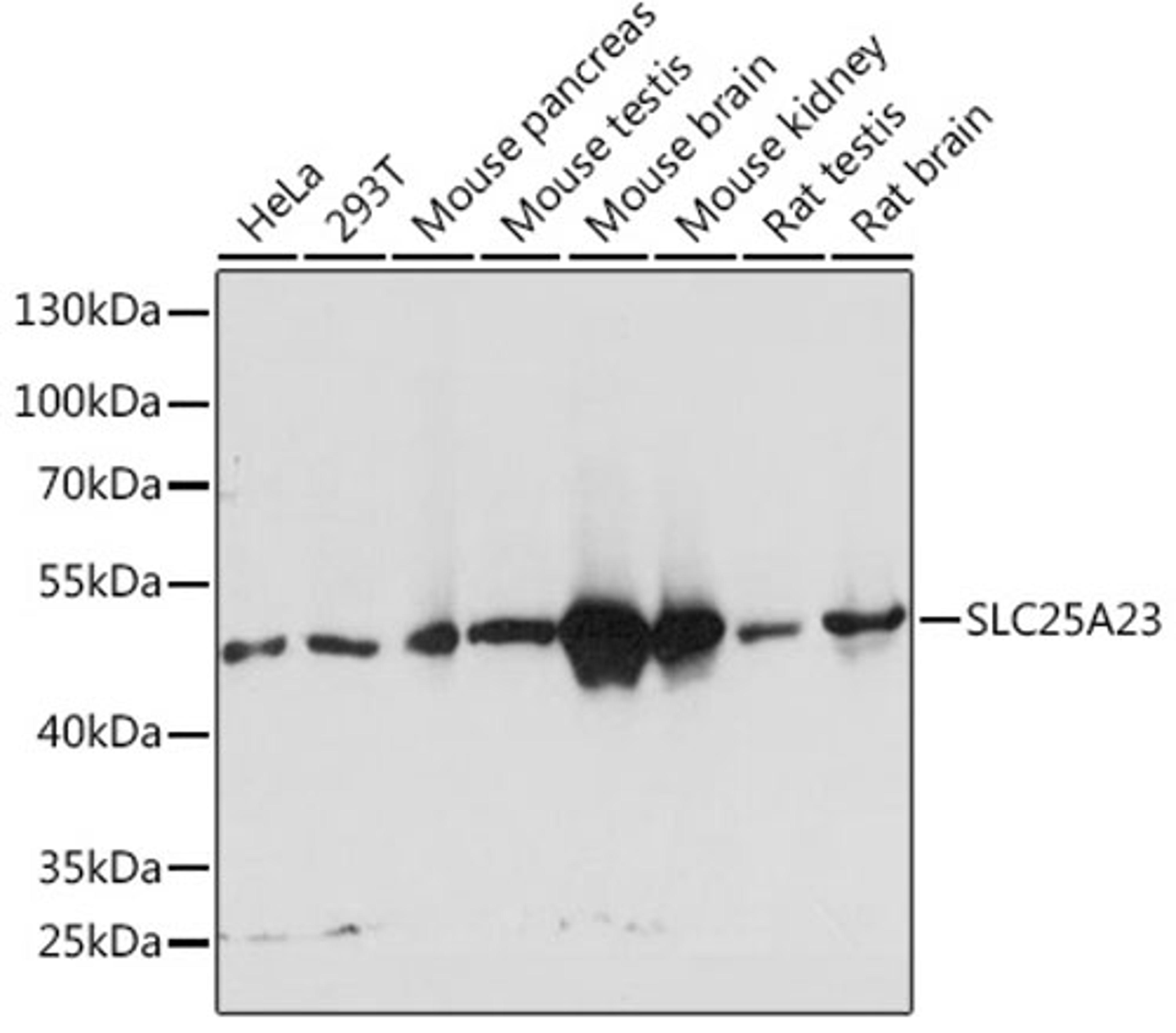 Western blot - SLC25A23 Rabbit pAb (A14352)