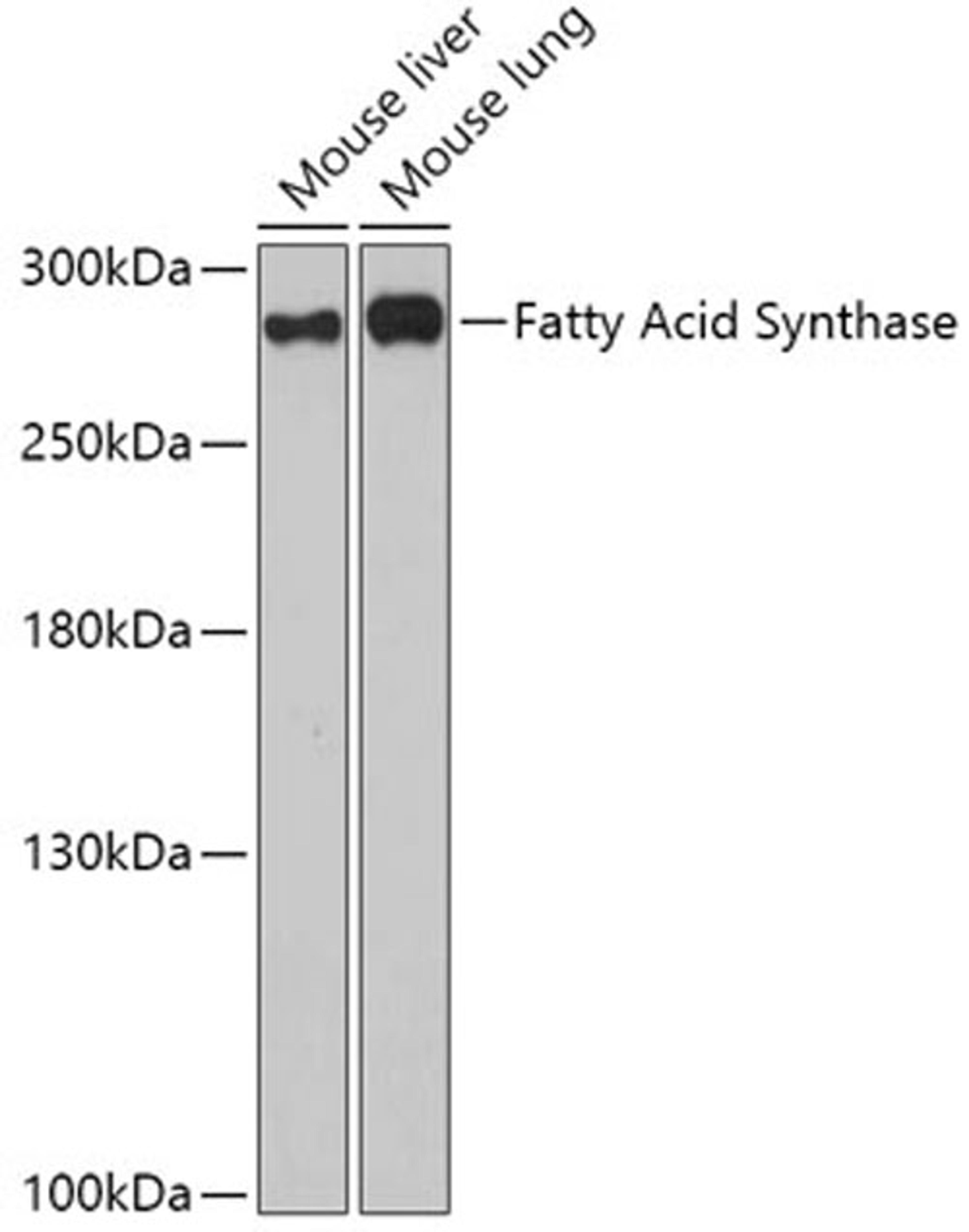 Western blot - Fatty Acid Synthase antibody (A0461)