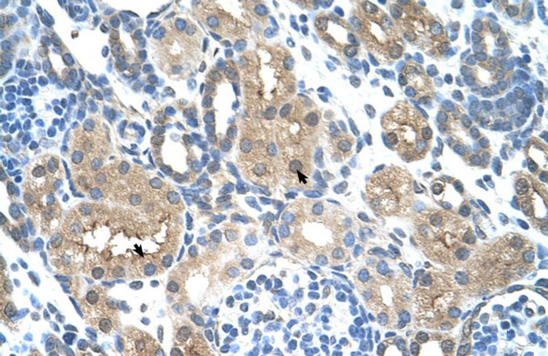 Antibody used in IHC on Human kidney lysate.