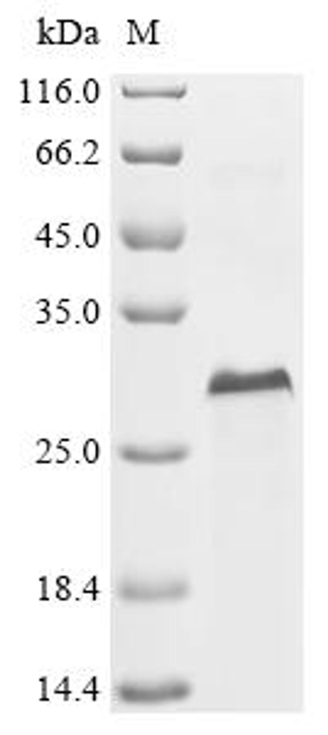 (Tris-Glycine gel) Discontinuous SDS-PAGE (reduced) with 5% enrichment gel and 15% separation gel.