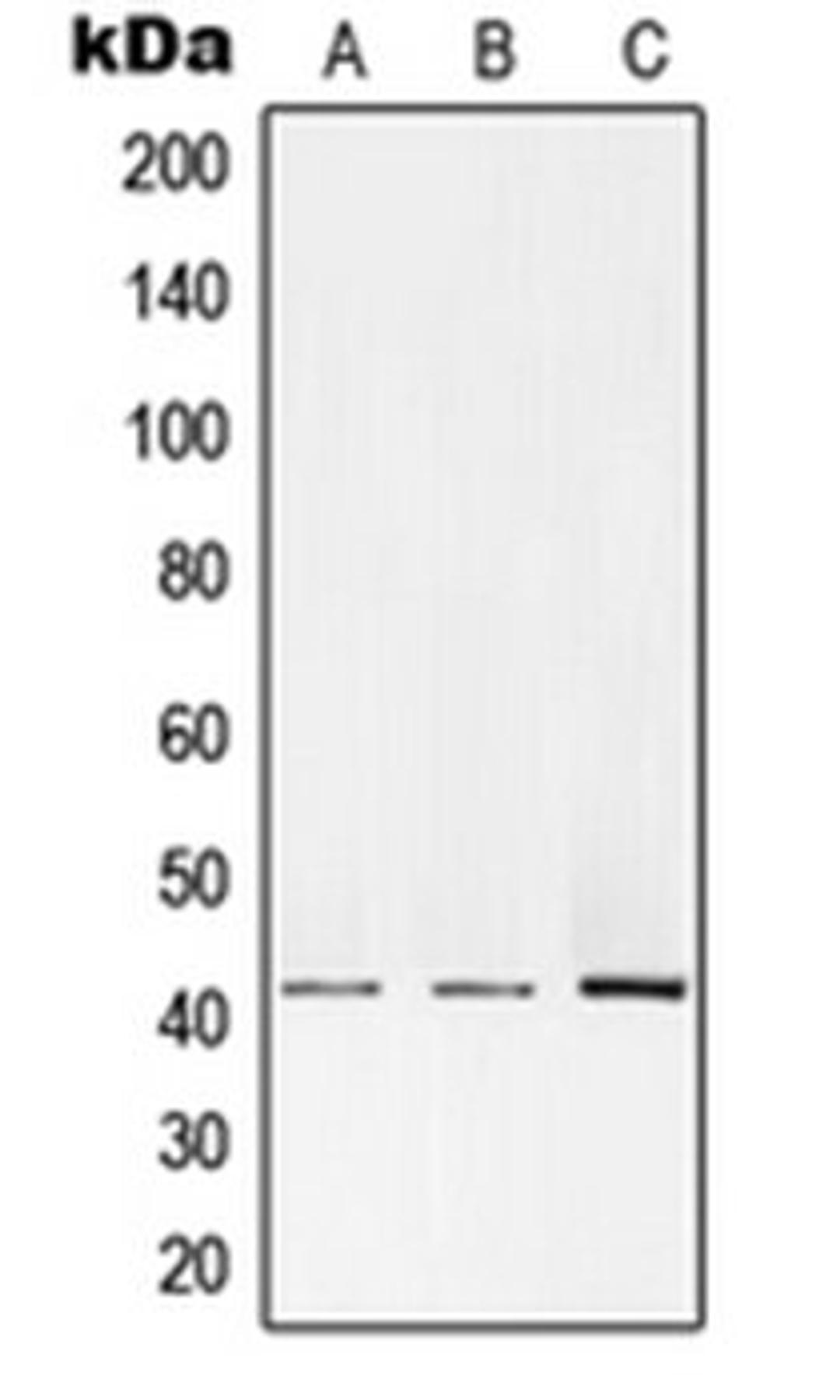 Western blot analysis of HEK293T (Lane 1), Raw264.7 (Lane 2), PC12 (Lane 3) whole cell lysates using PRKACA antibody