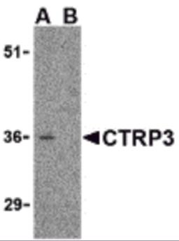 Western blot analysis of CTRP3 in mouse heart cell lysate with CTRP3 antibody at 1 &#956;g/mL in the (A) absence and (B) presence of blocking peptide.