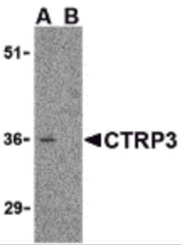 Western blot analysis of CTRP3 in mouse heart cell lysate with CTRP3 antibody at 1 μg/mL in the (A) absence and (B) presence of blocking peptide.