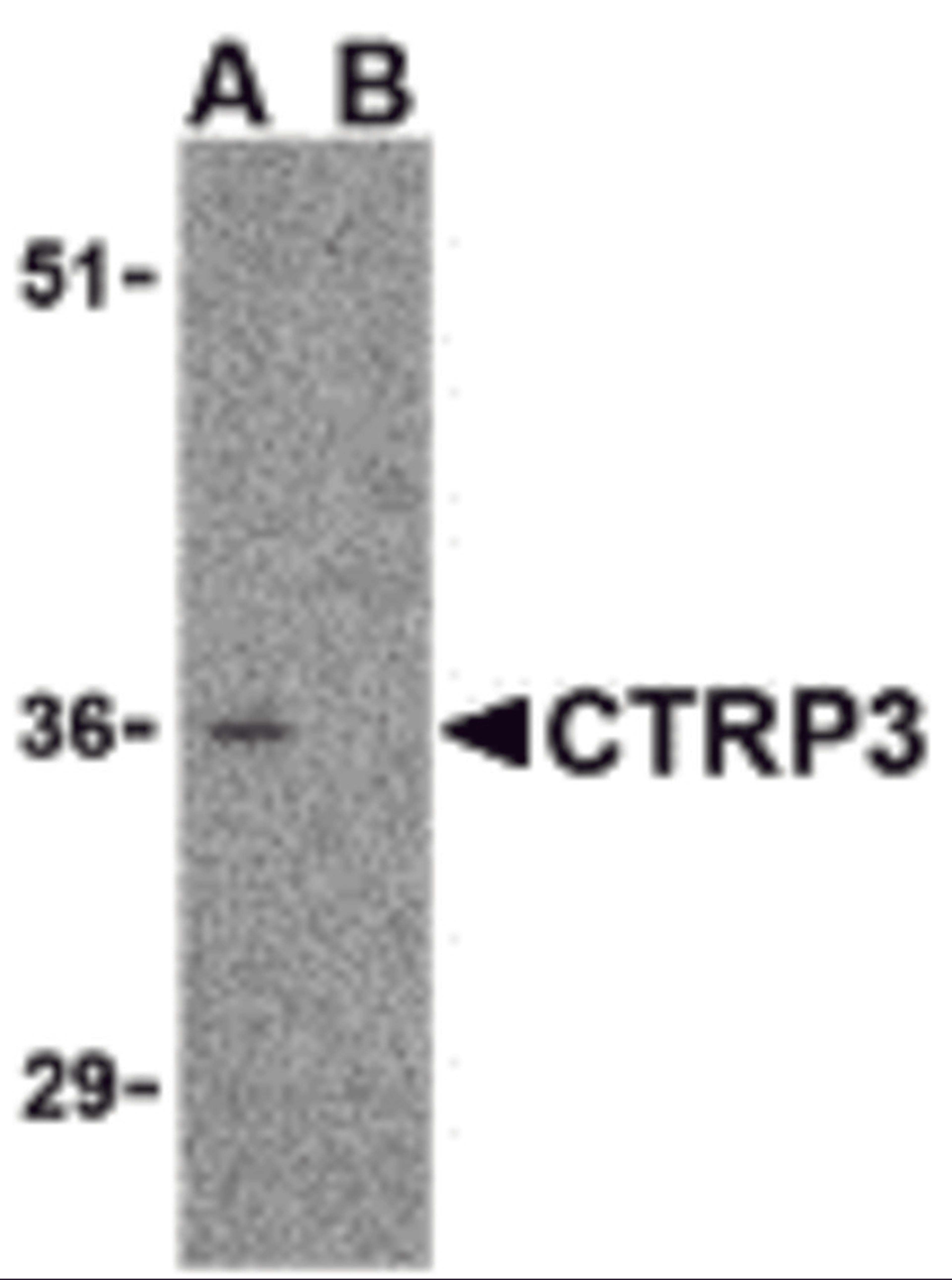 Western blot analysis of CTRP3 in mouse heart cell lysate with CTRP3 antibody at 1 μg/mL in the (A) absence and (B) presence of blocking peptide.