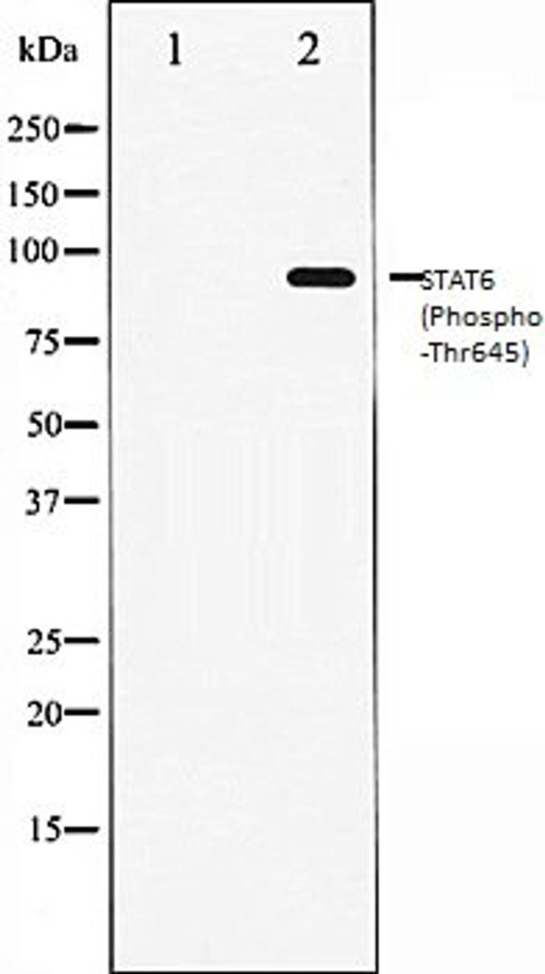 Western blot analysis of HeLa whole cell lysates using STAT6 (Phospho-Thr645) antibody, The lane on the left is treated with the antigen-specific peptide.