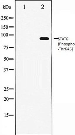 Western blot analysis of HeLa whole cell lysates using STAT6 (Phospho-Thr645) antibody, The lane on the left is treated with the antigen-specific peptide.