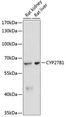 Western blot - CYP27B1 antibody (A1716)