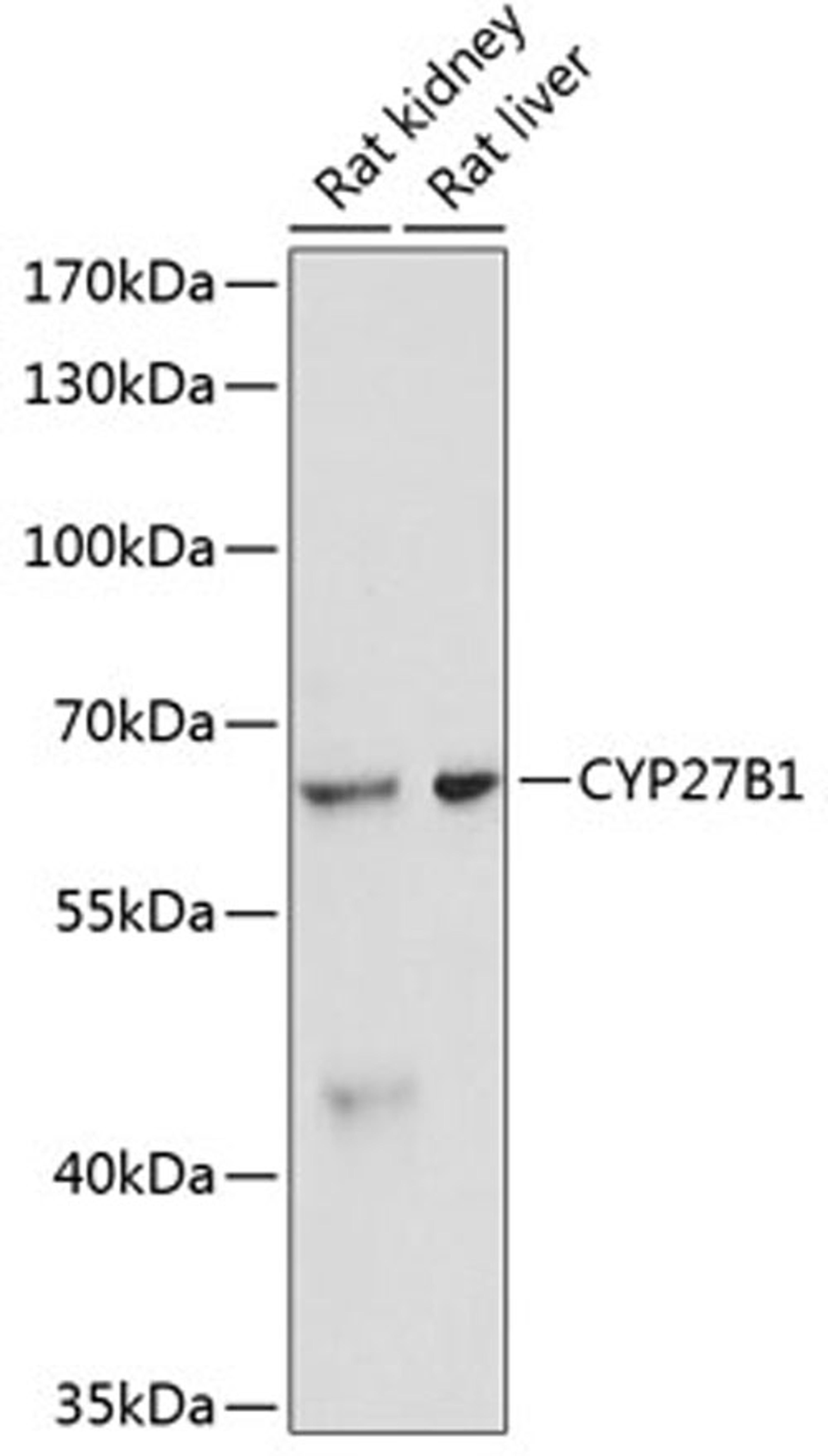 Western blot - CYP27B1 antibody (A1716)