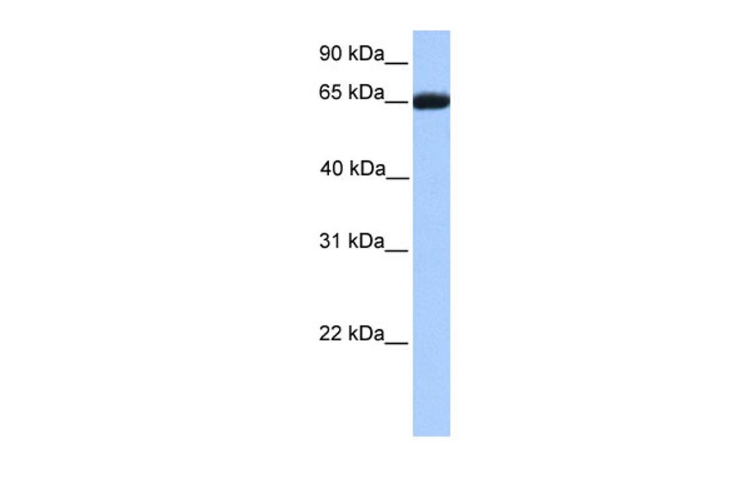 Antibody used in WB on Human Placenta at 0.2-1 ug/ml.