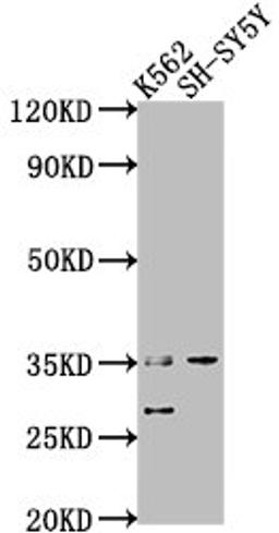 Western Blot. Positive WB detected in: K562 whole cell lysate, SH-SY5Y whole cell lysate. All lanes: THOC6 antibody at 1:2000. Secondary. Goat polyclonal to rabbit IgG at 1/50000 dilution. Predicted band size: 38, 35, 33 kDa. Observed band size: 35 kDa.