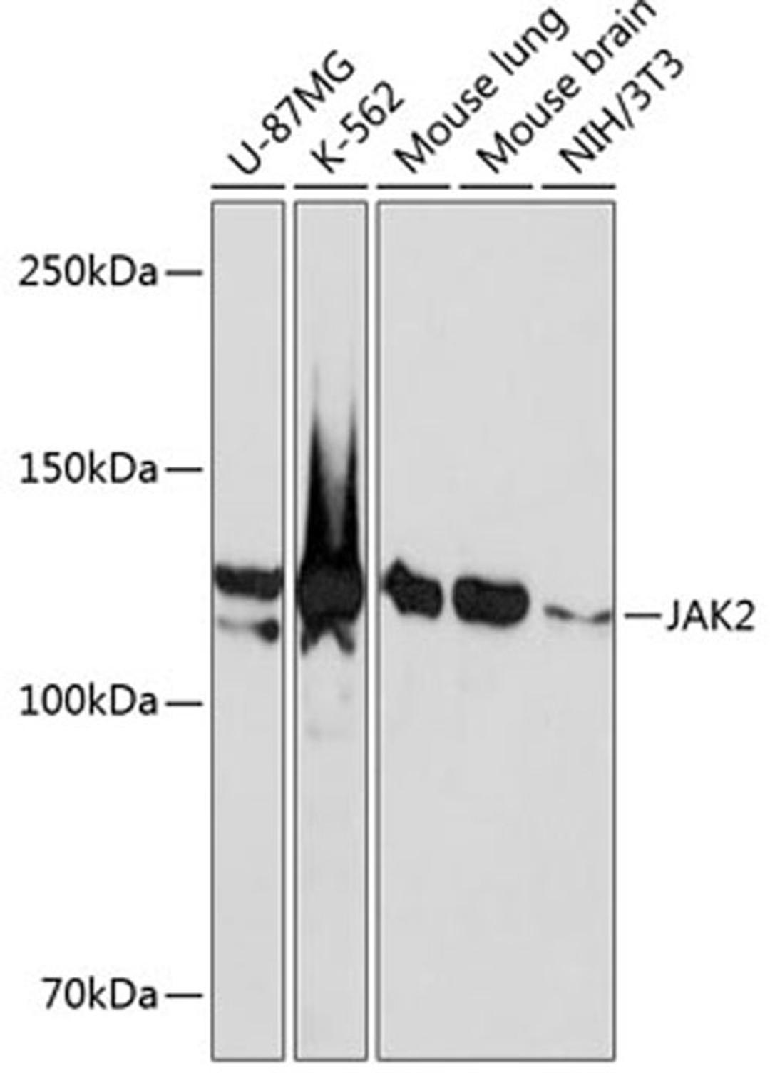 Western blot - JAK2 antibody (A19629)