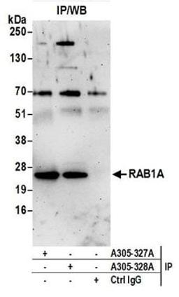 Detection of human RAB1A by western blot of immunoprecipitates.