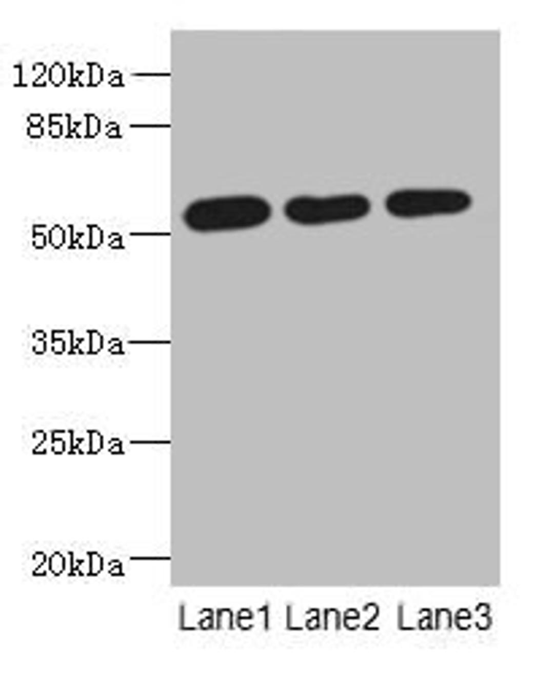 Western blot. All lanes: ARMT1 antibody at 0.6µg/ml. Lane 1: MCF-7 whole cell lysate. Lane 2: A431 whole cell lysate. Lane 3: 293T whole cell lysate. Secondary. Goat polyclonal to rabbit IgG at 1/10000 dilution. Predicted band size: 52 kDa. Observed band size: 52 kDa