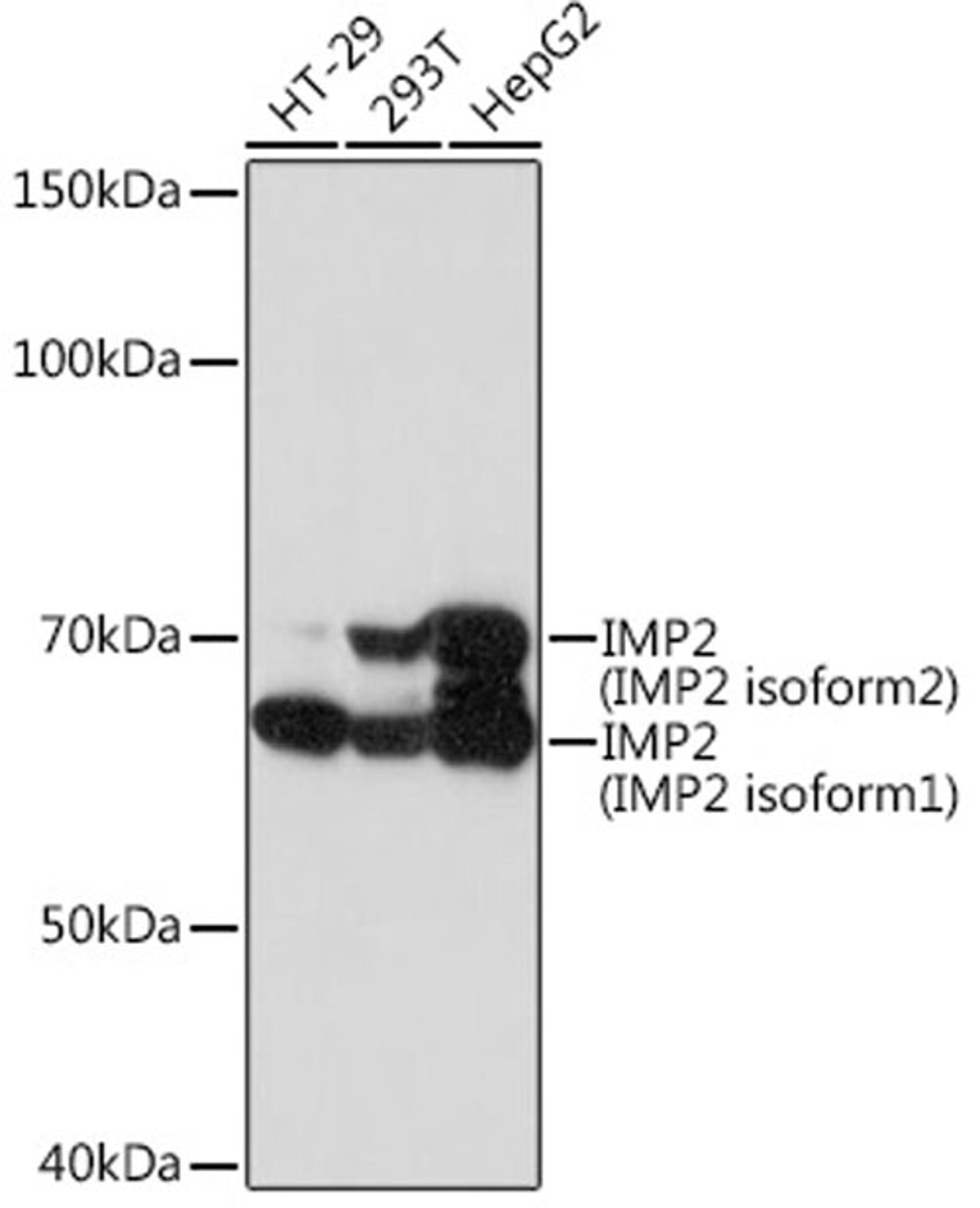 Western blot - IMP2 Rabbit mAb (A5189)