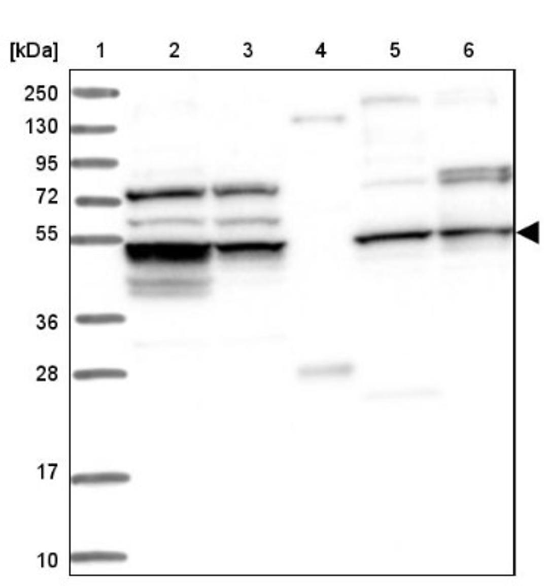 Western Blot: CEP57L1 Antibody [NBP1-88761] - Lane 1: Marker [kDa] 250, 130, 95, 72, 55, 36, 28, 17, 10<br/>Lane 2: Human cell line RT-4<br/>Lane 3: Human cell line U-251MG sp<br/>Lane 4: Human plasma (IgG/HSA depleted)<br/>Lane 5: Human liver tissue<br/>Lane 6: Human tonsil tissue