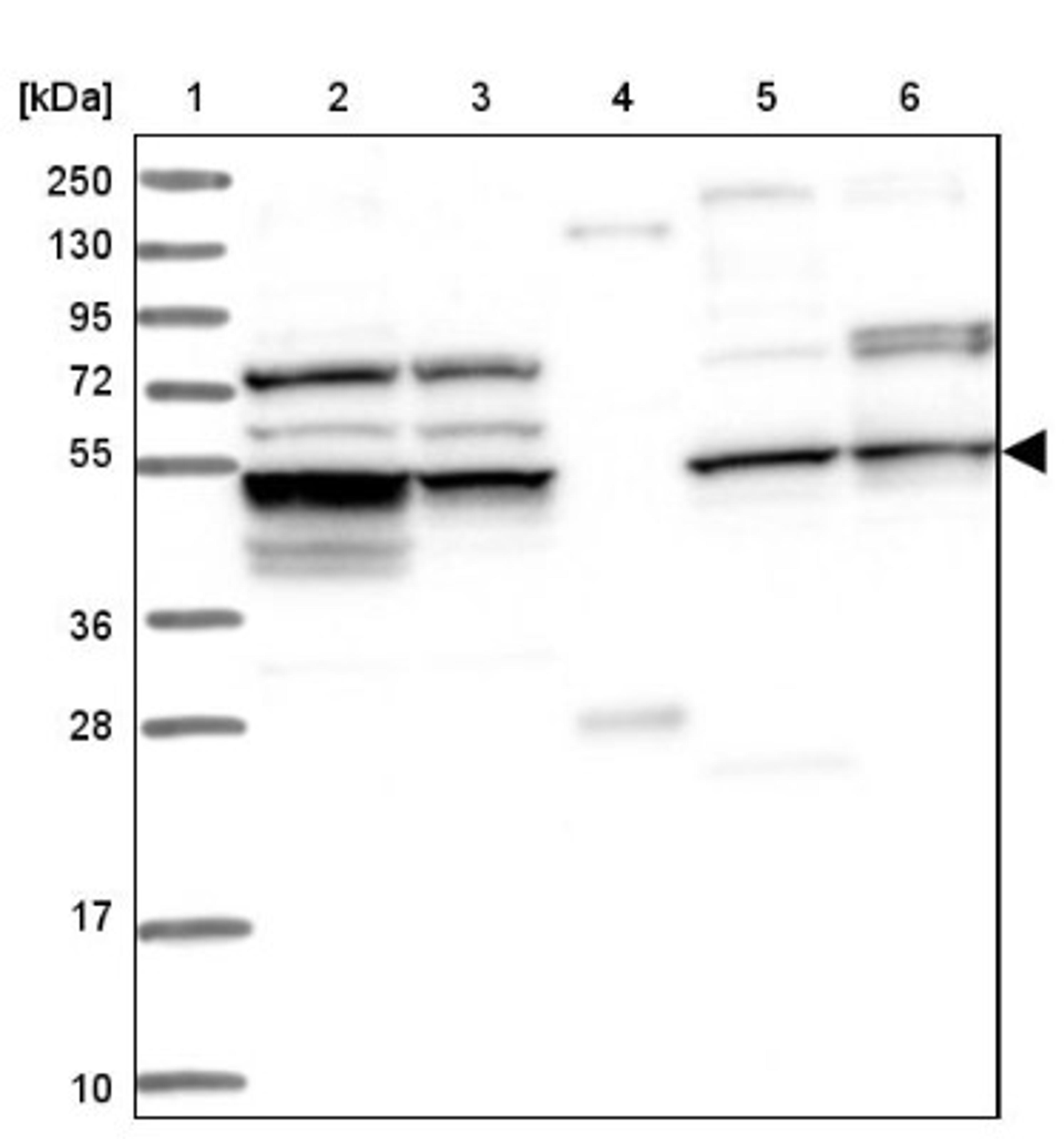 Western Blot: CEP57L1 Antibody [NBP1-88761] - Lane 1: Marker [kDa] 250, 130, 95, 72, 55, 36, 28, 17, 10<br/>Lane 2: Human cell line RT-4<br/>Lane 3: Human cell line U-251MG sp<br/>Lane 4: Human plasma (IgG/HSA depleted)<br/>Lane 5: Human liver tissue<br/>Lane 6: Human tonsil tissue