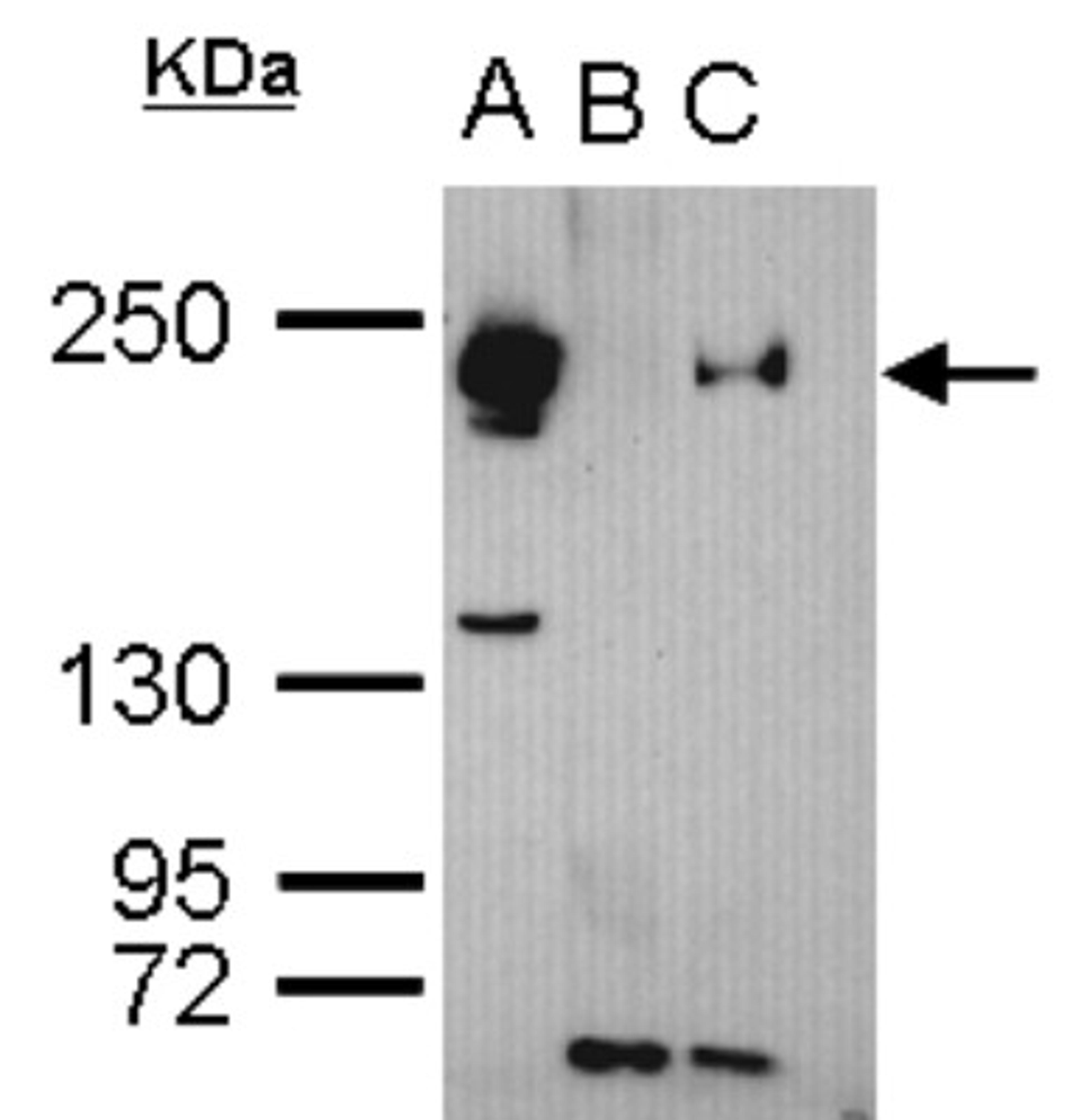 Immunoprecipitation: TET3 Antibody [NBP2-20602] - Sample: cell lysate/extract of TET3 gene transfected 293T cells A. Cell lysate/extract of transfected 293T cell B. Control with 2 ug of preimmune rabbit IgG C. Immunoprecipitation of TET3 by 2 ug of TET3 antibody 5% SDS-PAGE The immunoprecipitated TET3 protein was detected by TET3 antibody diluted at 1:1000.  anti-rabbit IgG was used as a secondary reagent.