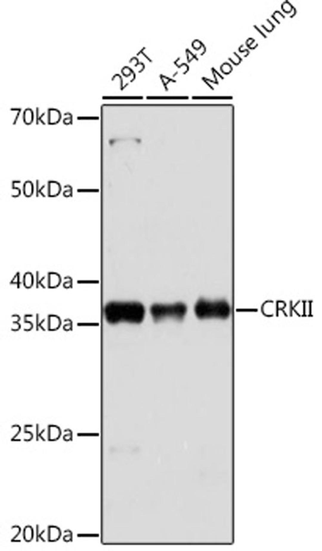 Western blot - CRKII Rabbit mAb (A9577)